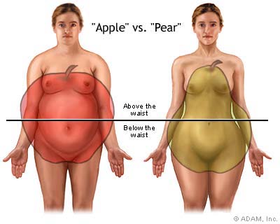Body Fat Distribution: Apple vs. Pear