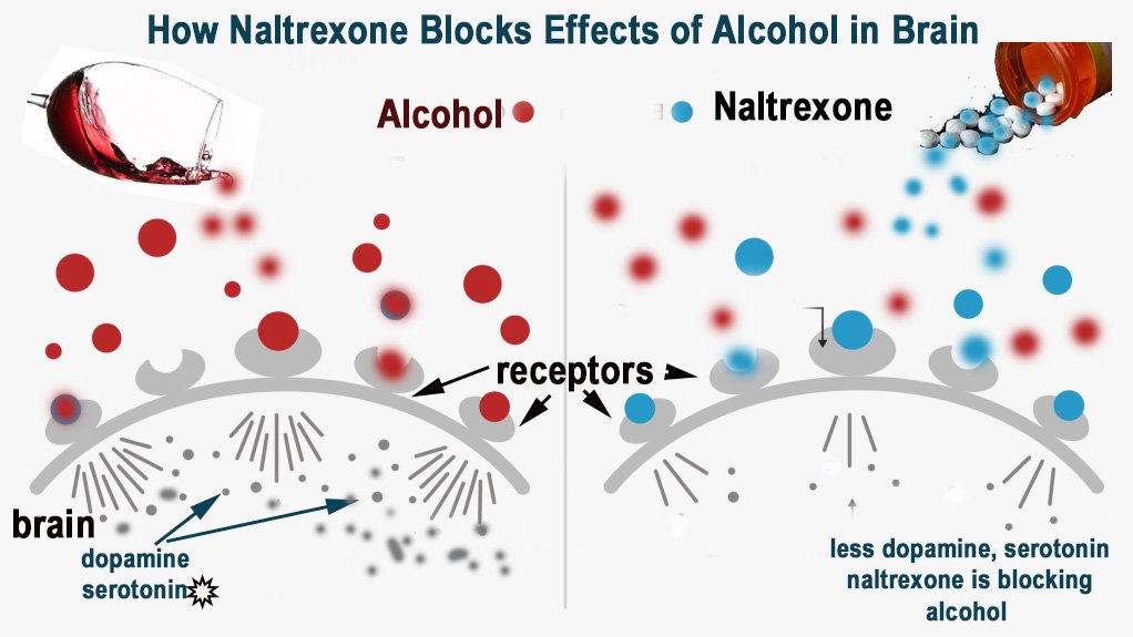 Naltrexone blocks alcohol effects in brain