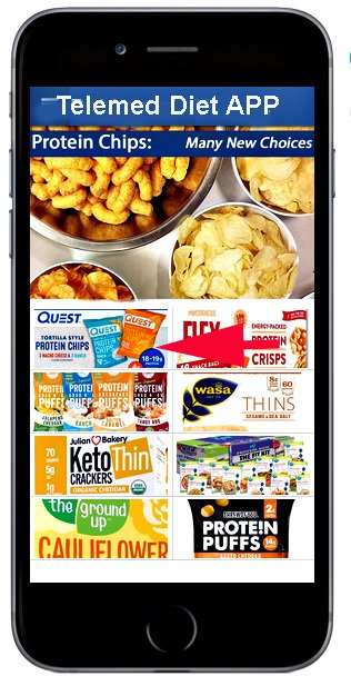 Telemedicine Diet App: Chips Telemedicine Diet App: Chips