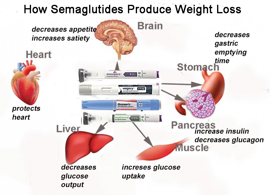 How semaglutides produce dramatic and safe weight loss