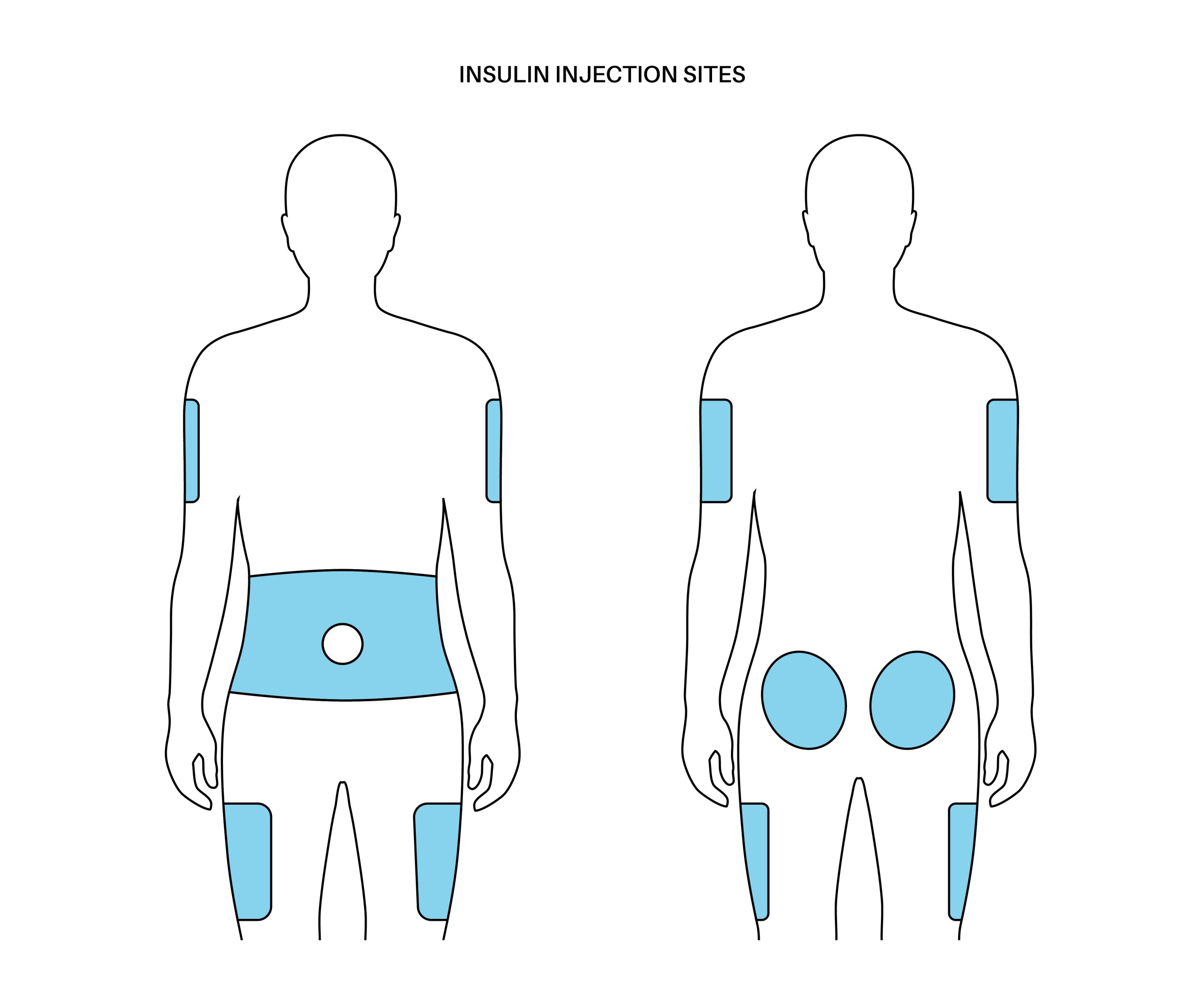 Injection sites for semaglutide weight loss weekly injectionss 